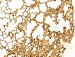 AEBP2 Antibody in Immunohistochemistry (Paraffin) (IHC (P))