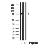 CCDC22 Antibody in Western Blot (WB)