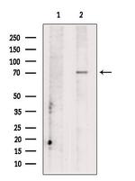 CCDC22 Antibody in Western Blot (WB)