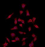 CHMP4B Antibody in Immunocytochemistry (ICC/IF)