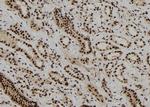 DBR1 Antibody in Immunohistochemistry (Paraffin) (IHC (P))