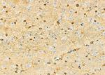 DBR1 Antibody in Immunohistochemistry (Paraffin) (IHC (P))