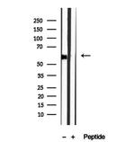 DBR1 Antibody in Western Blot (WB)