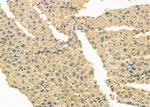 HERPUD1 Antibody in Immunohistochemistry (Paraffin) (IHC (P))