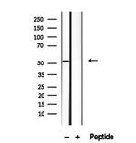 HERPUD1 Antibody in Western Blot (WB)