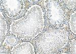 HDGFRP2 Antibody in Immunohistochemistry (Paraffin) (IHC (P))