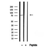 HDGFRP2 Antibody in Western Blot (WB)