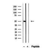 PMPCB Antibody in Western Blot (WB)