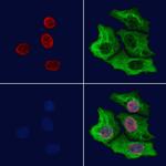 SFPQ Antibody in Immunocytochemistry (ICC/IF)