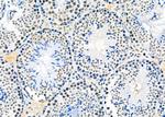 SFPQ Antibody in Immunohistochemistry (Paraffin) (IHC (P))