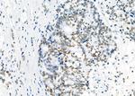 SFPQ Antibody in Immunohistochemistry (Paraffin) (IHC (P))