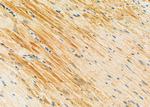 SULT1C2 Antibody in Immunohistochemistry (Paraffin) (IHC (P))