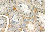 SULT1C2 Antibody in Immunohistochemistry (Paraffin) (IHC (P))