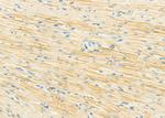 SULT1C2 Antibody in Immunohistochemistry (Paraffin) (IHC (P))