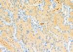 SULT1C2 Antibody in Immunohistochemistry (Paraffin) (IHC (P))