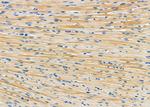 SULT1C2 Antibody in Immunohistochemistry (Paraffin) (IHC (P))