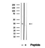 SULT1C2 Antibody in Western Blot (WB)