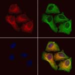 TMOD1 Antibody in Immunocytochemistry (ICC/IF)