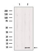 TMSB4X Antibody in Western Blot (WB)