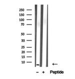 TMSB4X Antibody in Western Blot (WB)