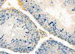 UQCRC1 Antibody in Immunohistochemistry (Paraffin) (IHC (P))