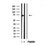 ATP6V1A Antibody in Western Blot (WB)