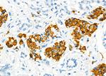 BAMBI Antibody in Immunohistochemistry (Paraffin) (IHC (P))