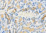 BAMBI Antibody in Immunohistochemistry (Paraffin) (IHC (P))