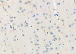 BAMBI Antibody in Immunohistochemistry (Paraffin) (IHC (P))