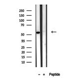 BAMBI Antibody in Western Blot (WB)