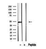 CCBL1 Antibody in Western Blot (WB)