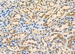 SH3KBP1 Antibody in Immunohistochemistry (Paraffin) (IHC (P))