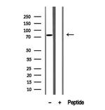 SH3KBP1 Antibody in Western Blot (WB)