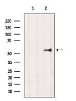 CAT1 Antibody in Western Blot (WB)