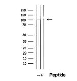 DIS3 Antibody in Western Blot (WB)