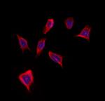 GMFG Antibody in Immunocytochemistry (ICC/IF)