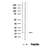 GMFG Antibody in Western Blot (WB)