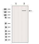 KIDINS220 Antibody in Western Blot (WB)