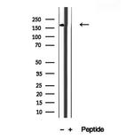 KIDINS220 Antibody in Western Blot (WB)