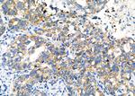 LAPTM4B Antibody in Immunohistochemistry (Paraffin) (IHC (P))