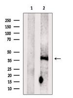 LAPTM4B Antibody in Western Blot (WB)