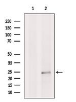 LAPTM4B Antibody in Western Blot (WB)