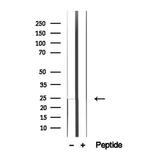 LAPTM4B Antibody in Western Blot (WB)