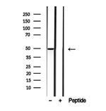 MMP28 Antibody in Western Blot (WB)