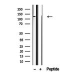 NCKAP1 Antibody in Western Blot (WB)