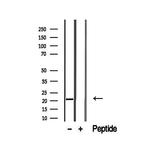 OBFC2A Antibody in Western Blot (WB)