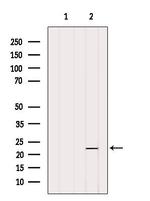 OBFC2A Antibody in Western Blot (WB)