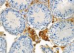 P4HA2 Antibody in Immunohistochemistry (Paraffin) (IHC (P))