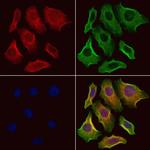 PAFAH2 Antibody in Immunocytochemistry (ICC/IF)