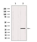 PHF19 Antibody in Western Blot (WB)